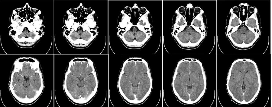 Concussions+in+gym+class+affect+students%E2%80%99+athletic+careers